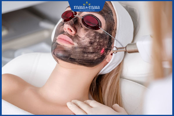 Trẻ hóa da bằng laser carbon có hiệu quả không? Thực hiện thế nào? 2 bắn laser carbon trẻ hóa