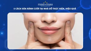 5 cách xóa rãnh cười tại nhà dễ thực hiện, hiệu quả 34 cách xóa rãnh cười tại nhà