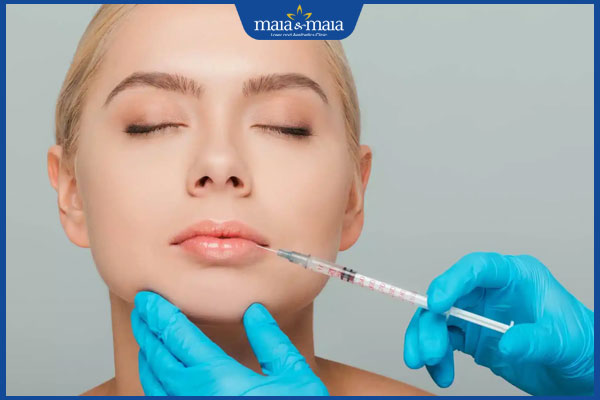 Tiêm filler môi loại nào tốt? Các tiêu chí chọn filler chất lượng 8 cảm giác khi tiêm filler môi