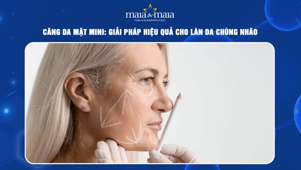 Căng da mặt mini