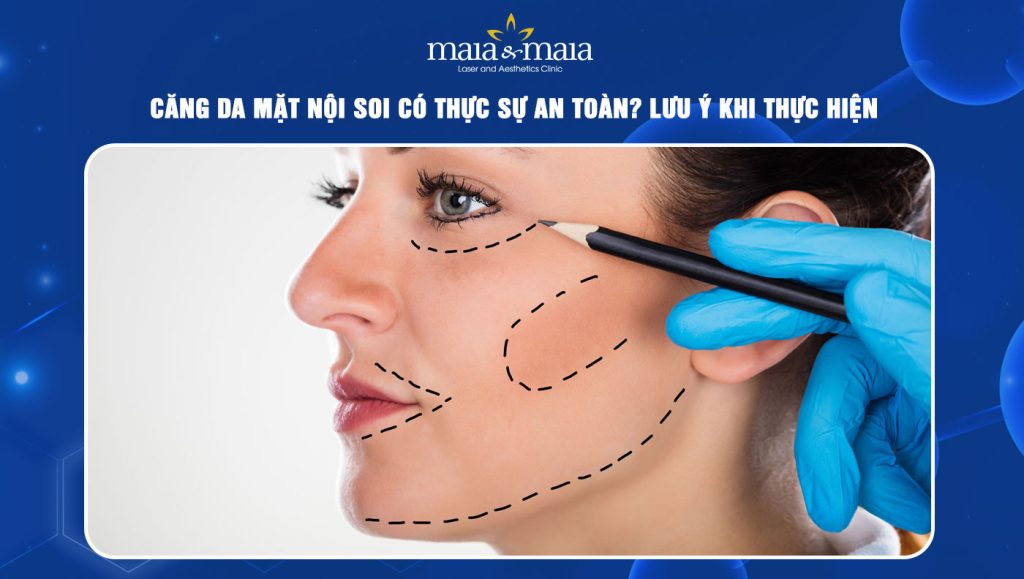 căng da mặt nội soi