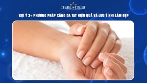 Gợi ý 3+ phương pháp căng da tay hiệu quả và lưu ý khi làm đẹp 85 căng da tay
