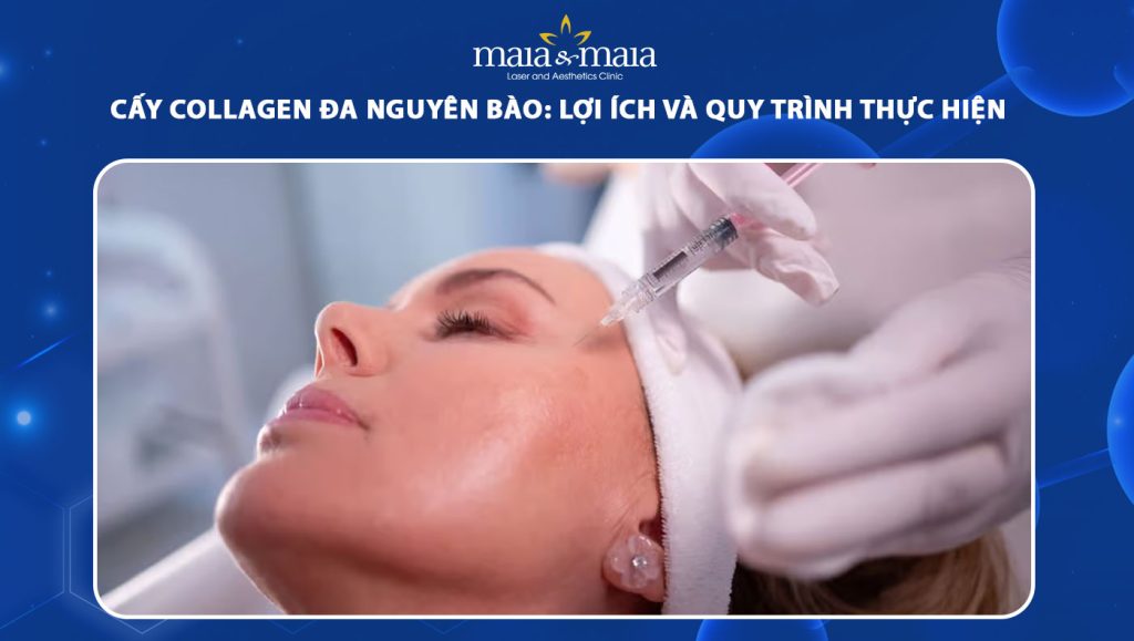 cấy collagen đa nguyên bào