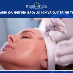cấy collagen đa nguyên bào