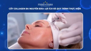 Cấy collagen đa nguyên bào: Lợi ích và quy trình thực hiện 95 cấy collagen đa nguyên bào