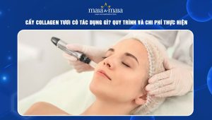 Cấy collagen tươi có tác dụng gì? Quy trình và chi phí thực hiện 73 Cấy collagen tươi
