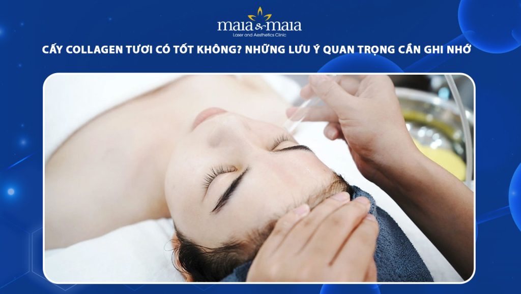 cấy collagen tươi có tốt không