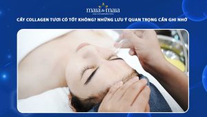 Cấy collagen tươi có tốt không? Những lưu ý quan trọng cần ghi nhớ khi làm đẹp 28 cấy collagen tươi có tốt không