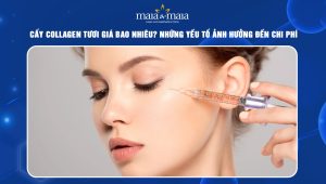 Cấy collagen tươi giá bao nhiêu