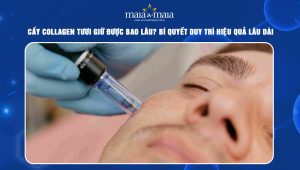 Cấy collagen tươi giữ được bao lâu? Bí quyết duy trì hiệu quả lâu dài  122 cấy collagen tươi giữ được bao lâu