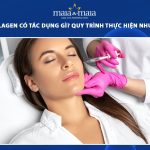 cấy ha collagen