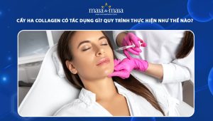 Cấy HA Collagen có tác dụng gì? Quy trình thực hiện như thế nào? 88 cấy ha collagen