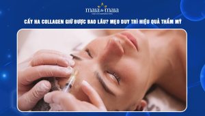 Cấy HA collagen giữ được bao lâu? Mẹo duy trì hiệu quả thẩm mỹ 75 cấy HA collagen giữ được bao lâu