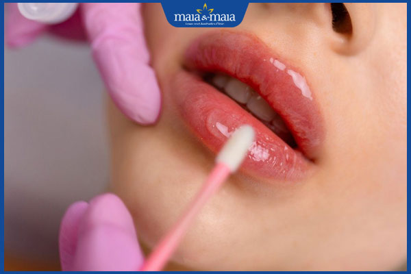 chăm sóc môi sau tiêm filler