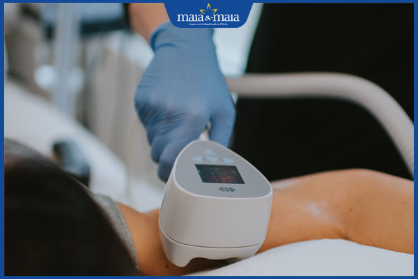 Công nghệ Exilis: Giải pháp giảm béo hiệu quả không phẫu thuật 6 chi phí exilis