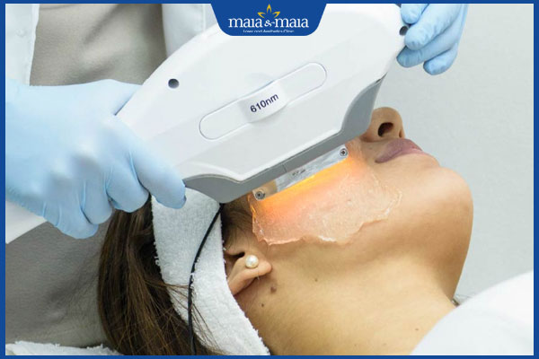 Trẻ hóa da bằng công nghệ Elight: Quy trình và lưu ý khi thực hiện 2 công nghệ elight