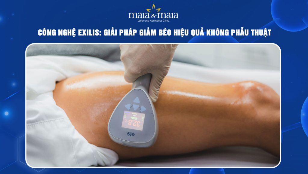 công nghệ Exilis
