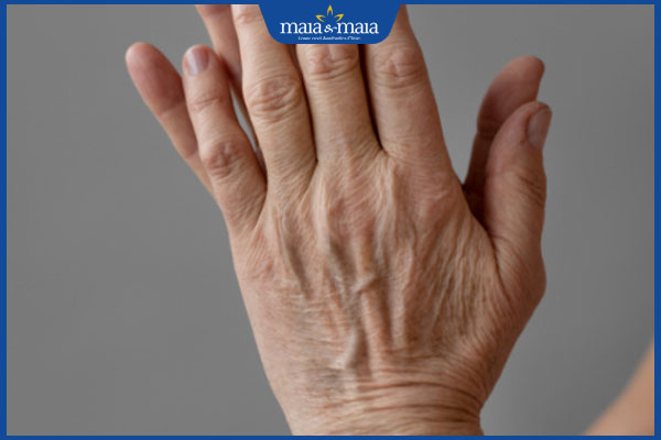 Trẻ hóa bàn tay cách nào hiệu quả? Địa chỉ trẻ hóa da tay uy tín 2 da tay lão hóa