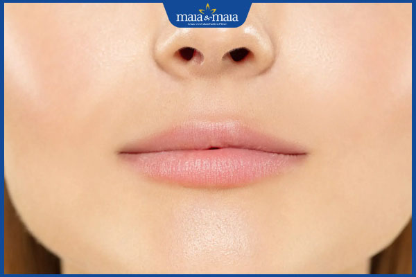 Có nên tiêm filler môi cherry không? Địa chỉ tiêm môi uy tín 3 dang moi mong