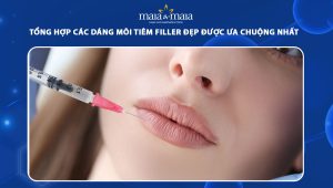 Tổng hợp các dáng môi tiêm filler đẹp được ưa chuộng nhất 77 dáng môi tiêm filler đẹp
