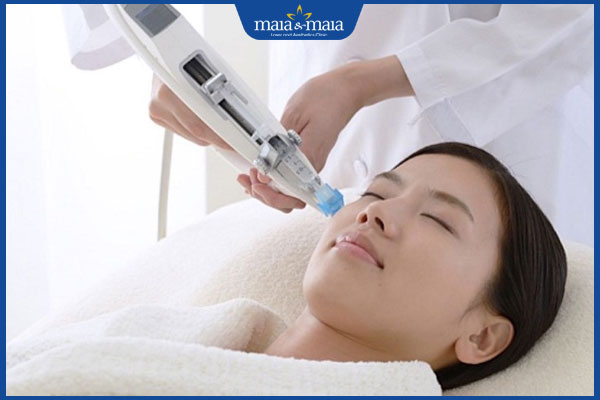 Tiêm meso bằng máy hay bằng tay tốt? Địa chỉ tiêm meso uy tín 2 dùng máy tiêm meso