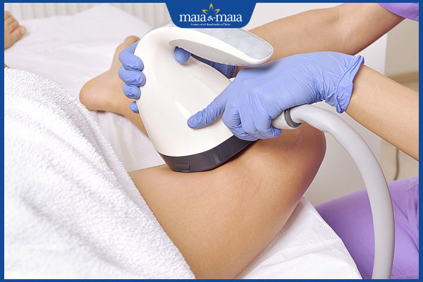 Công nghệ Exilis: Giải pháp giảm béo hiệu quả không phẫu thuật 2 exilis giảm mỡ