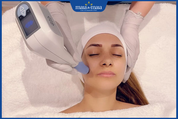 Công nghệ Exilis: Giải pháp giảm béo hiệu quả không phẫu thuật 5 exilis vùng mặt