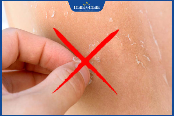 không bóc lột da