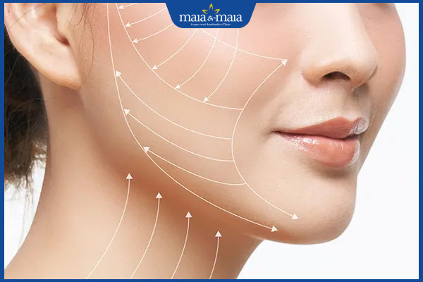 kỹ thuật căng da mini