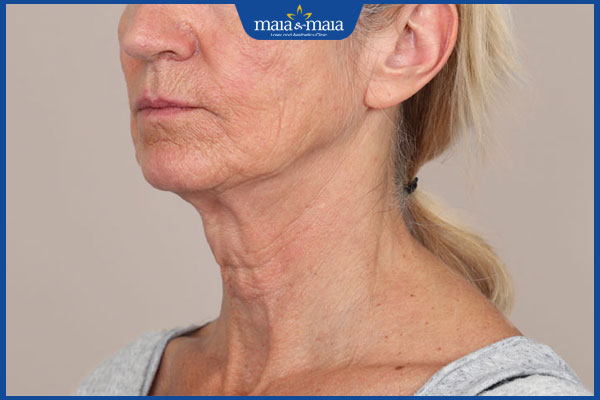 lão hóa trên 60 tuổi