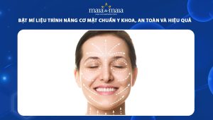 Bật mí liệu trình nâng cơ mặt chuẩn y khoa, đảm bảo an toàn và hiệu quả tốt nhất? 95 liệu trình nâng cơ mặt