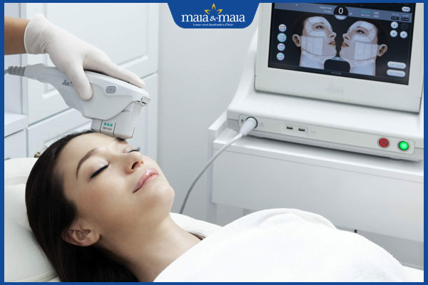 lợi ích khi trẻ hóa bằng ultherapy