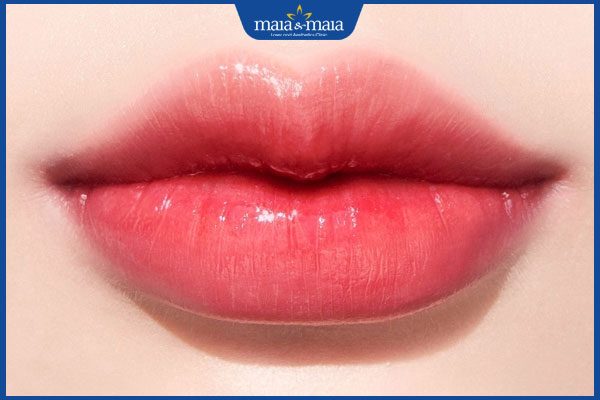 Môi dày có tiêm filler được không? Địa chỉ tiêm filler môi đẹp chuẩn 2 mẫu môi dáng cherry