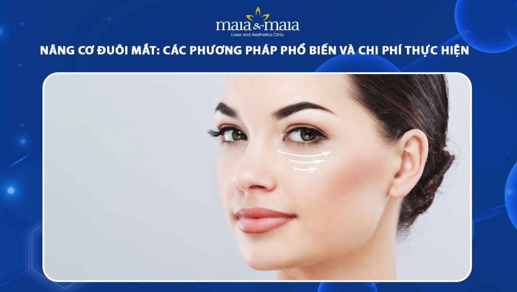 nâng cơ đuôi mắt