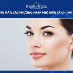 nâng cơ đuôi mắt