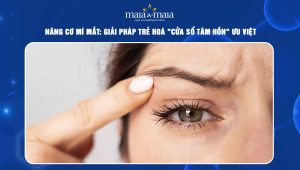 Nâng cơ mí mắt: Giải pháp trẻ hoá "cửa sổ tâm hồn" ưu việt 81 Nâng cơ mí mắt