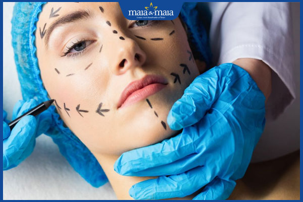 Xóa nếp nhăn rãnh mũi má như thế nào? Địa chỉ xóa nhăn uy tín 3 phẫu thuật căng da mặt nội soi