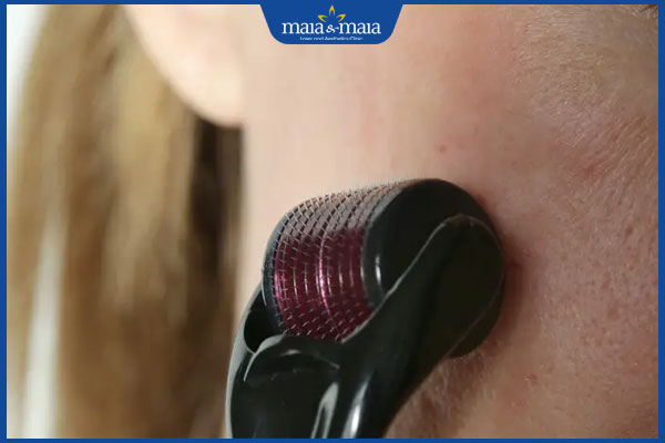 phương pháp lăn kim