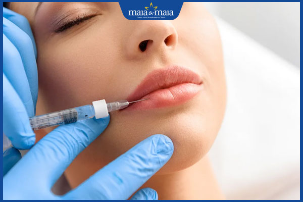 Tiêm filler môi loại nào tốt? Các tiêu chí chọn filler chất lượng 2 quá trình tiêm filler môi