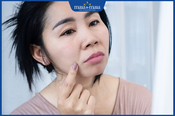 5 cách xóa rãnh cười tại nhà dễ thực hiện, hiệu quả 2 rãnh cười ở phụ nữ