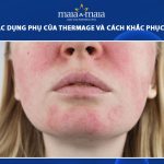 tác dụng phụ của thermage