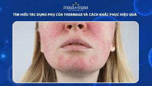 Tìm hiểu tác dụng phụ của Thermage và cách khắc phục hiệu quả 36 tác dụng phụ của thermage