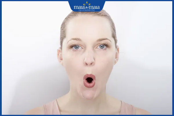 tạo hình khóe miệng