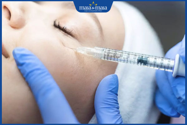 thực hiện tiêm filler bọng mắt