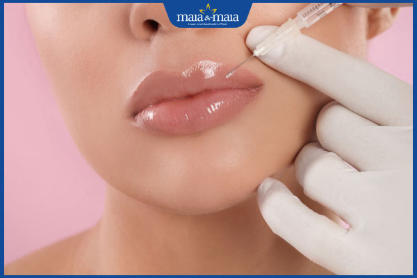 Tiêm filler môi loại nào tốt? Các tiêu chí chọn filler chất lượng 6 thực hiện tiêm filler môi