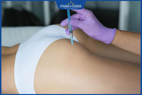 thực hiện tiêm filler mông