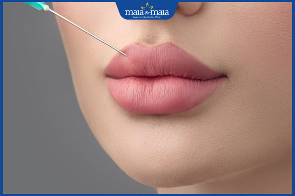 Tiêm môi tây căng mọng, quyến rũ: Xu hướng thẩm mỹ được giới trẻ ưa chuộng 2 thực hiện tiêm môi tây