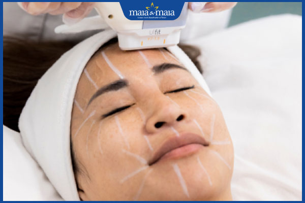 thực hiện trẻ hóa da bằng công nghệ hifu