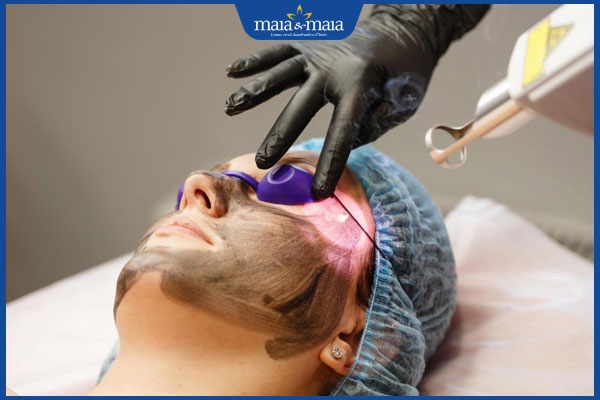 Trẻ hóa da bằng laser carbon có hiệu quả không? Thực hiện thế nào? 4 thực hiện trẻ hóa da bằng laser carbon