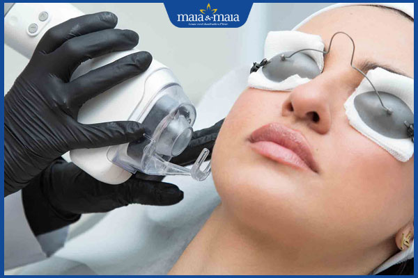 Trẻ hóa da bằng laser CO2 Fractional: Giải pháp làm đẹp đột phá cho làn da trẻ trung 2 thực hiện trẻ hóa da bằng laser fractional
